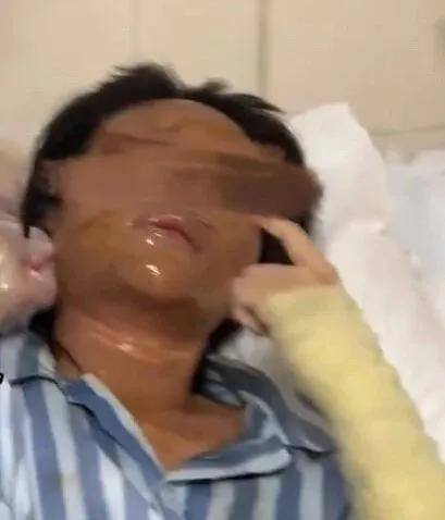 皇冠信用網网址_女主播称遭伪装快递包裹炸伤皇冠信用網网址，湖南警方通报